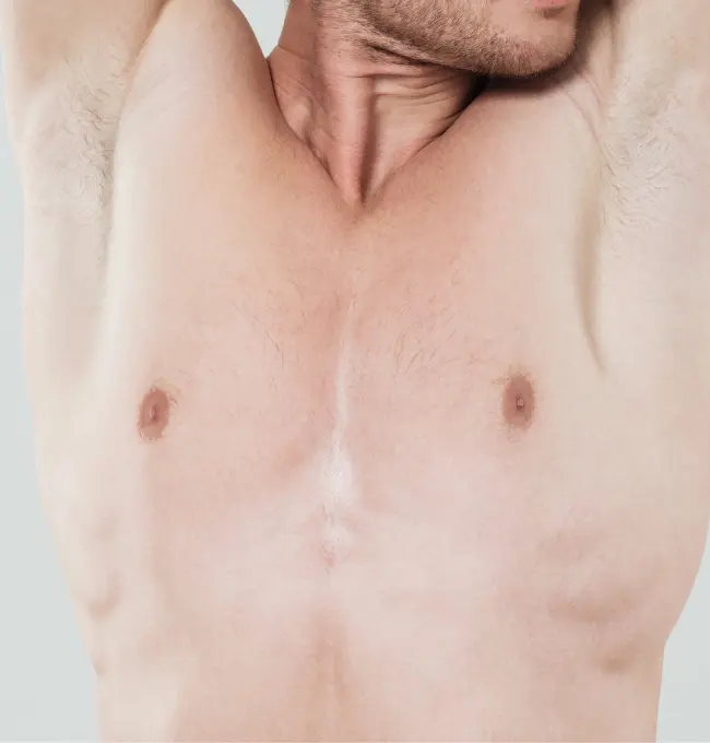 Areola